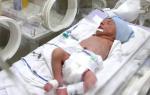 Определение степени недоношенности и гестационного возраста Рождение недоношенного ребенка